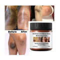 MÔOYAM Dark Knees and Elbows Strong Whitening Cream