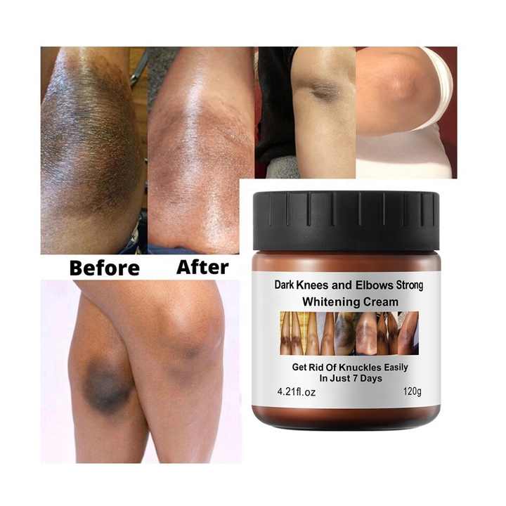 MÔOYAM Dark Knees and Elbows Strong Whitening Cream