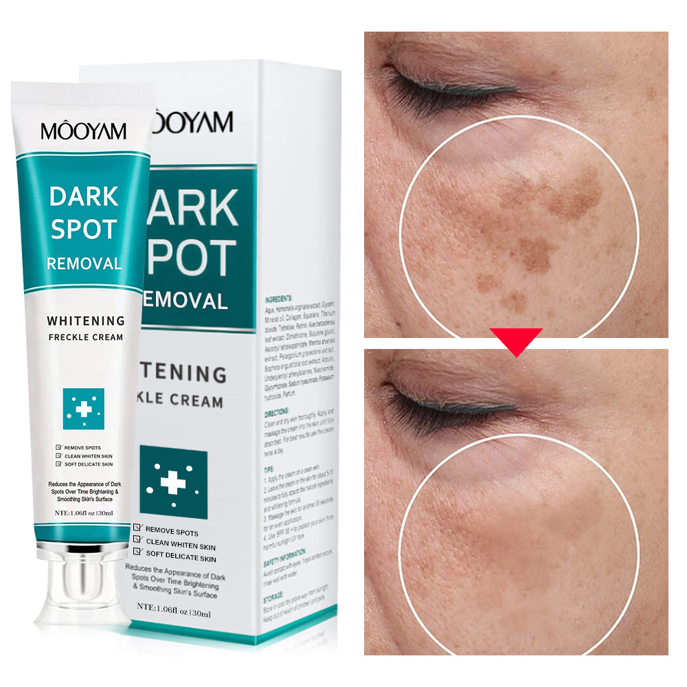 MÔOYAM Strong Effective Freckle Cream Removal Cream