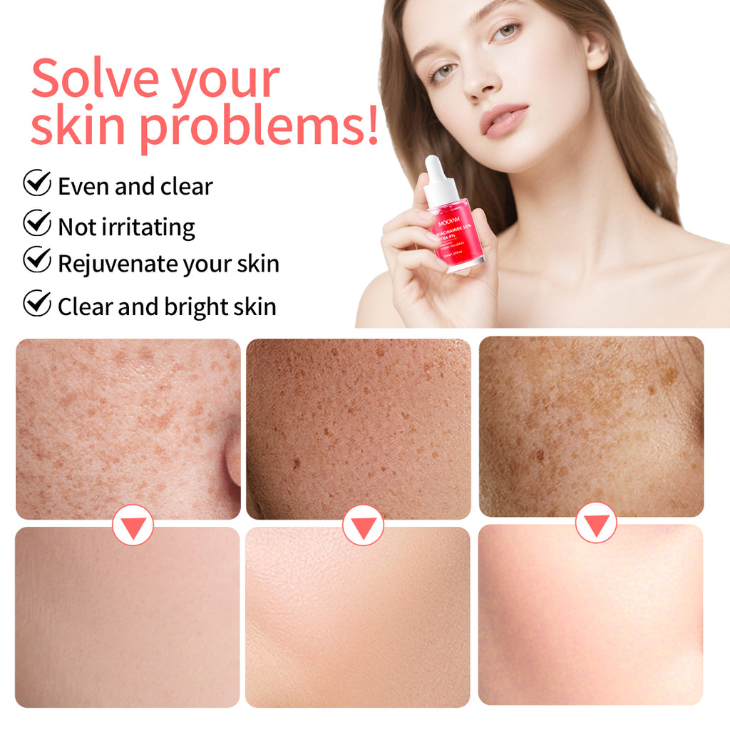 MÔOYAM Niacinamide Serum Dark Spot Remover Skin Brightener & Tone Corrector MOOYAM Facial Serum