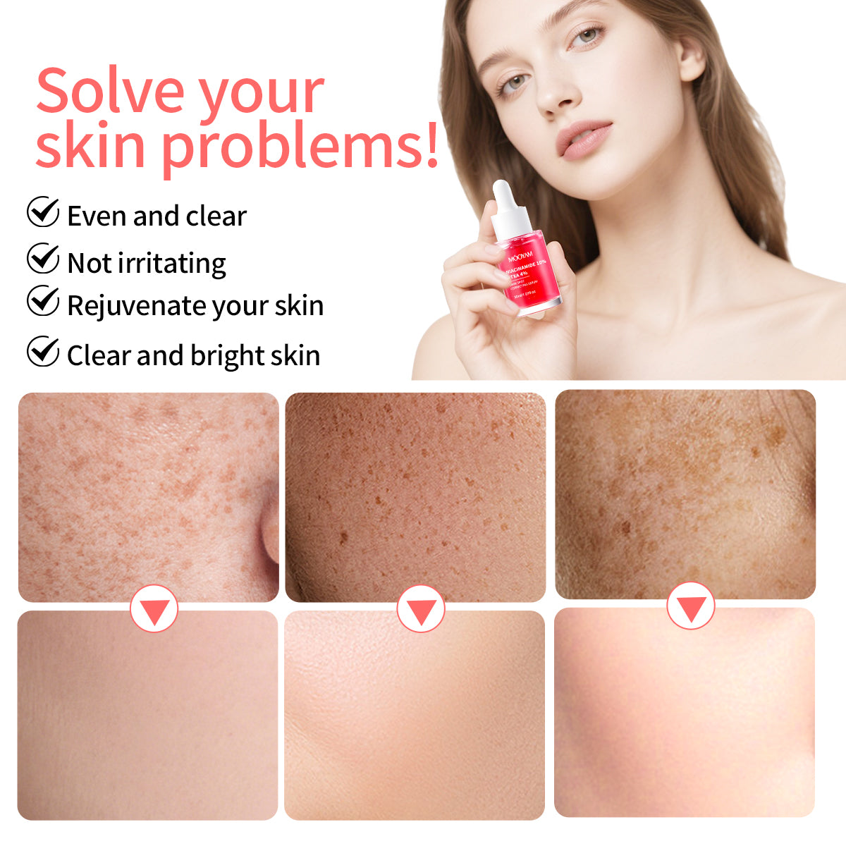 MÔOYAM Niacinamide Serum Dark Spot Remover Skin Brightener & Tone Corrector MOOYAM Facial Serum