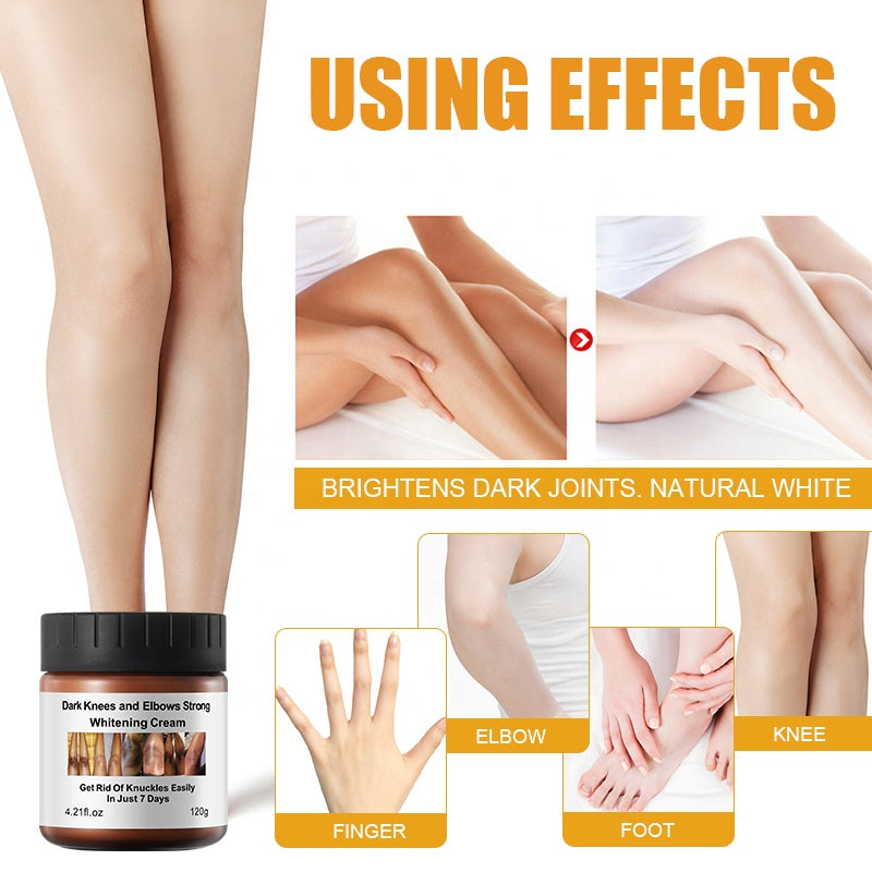 MÔOYAM Dark Knees and Elbows Strong Whitening Cream