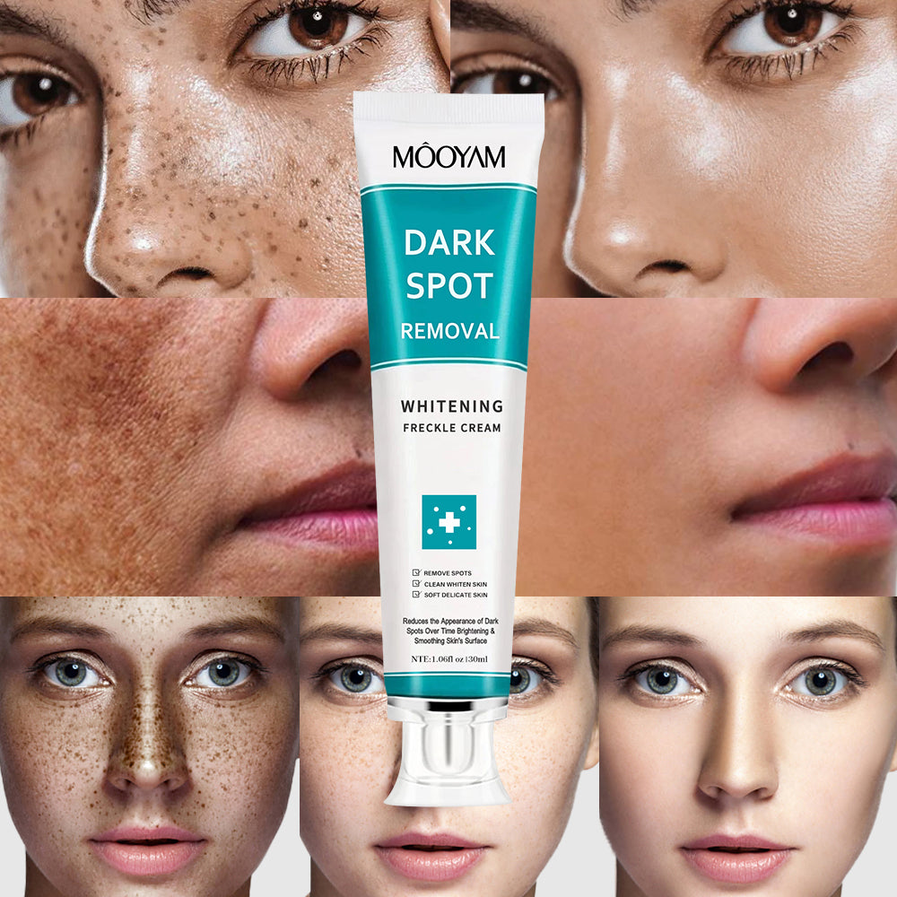 MÔOYAM Strong Effective Freckle Cream Removal Cream