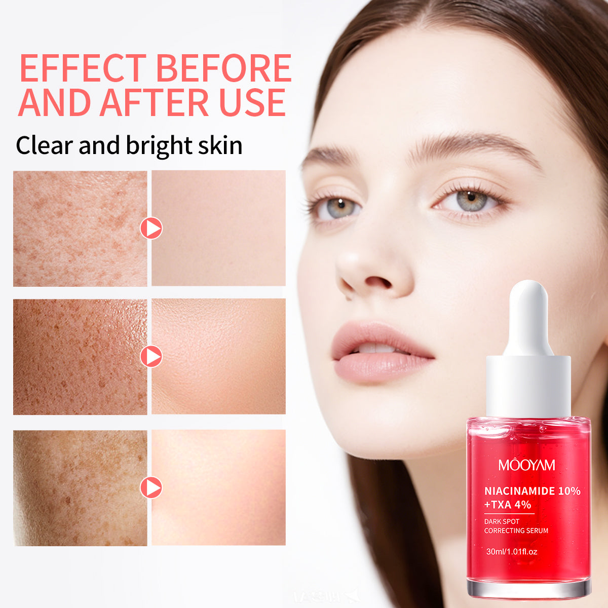 MÔOYAM Niacinamide Serum Dark Spot Remover Skin Brightener & Tone Corrector MOOYAM Facial Serum