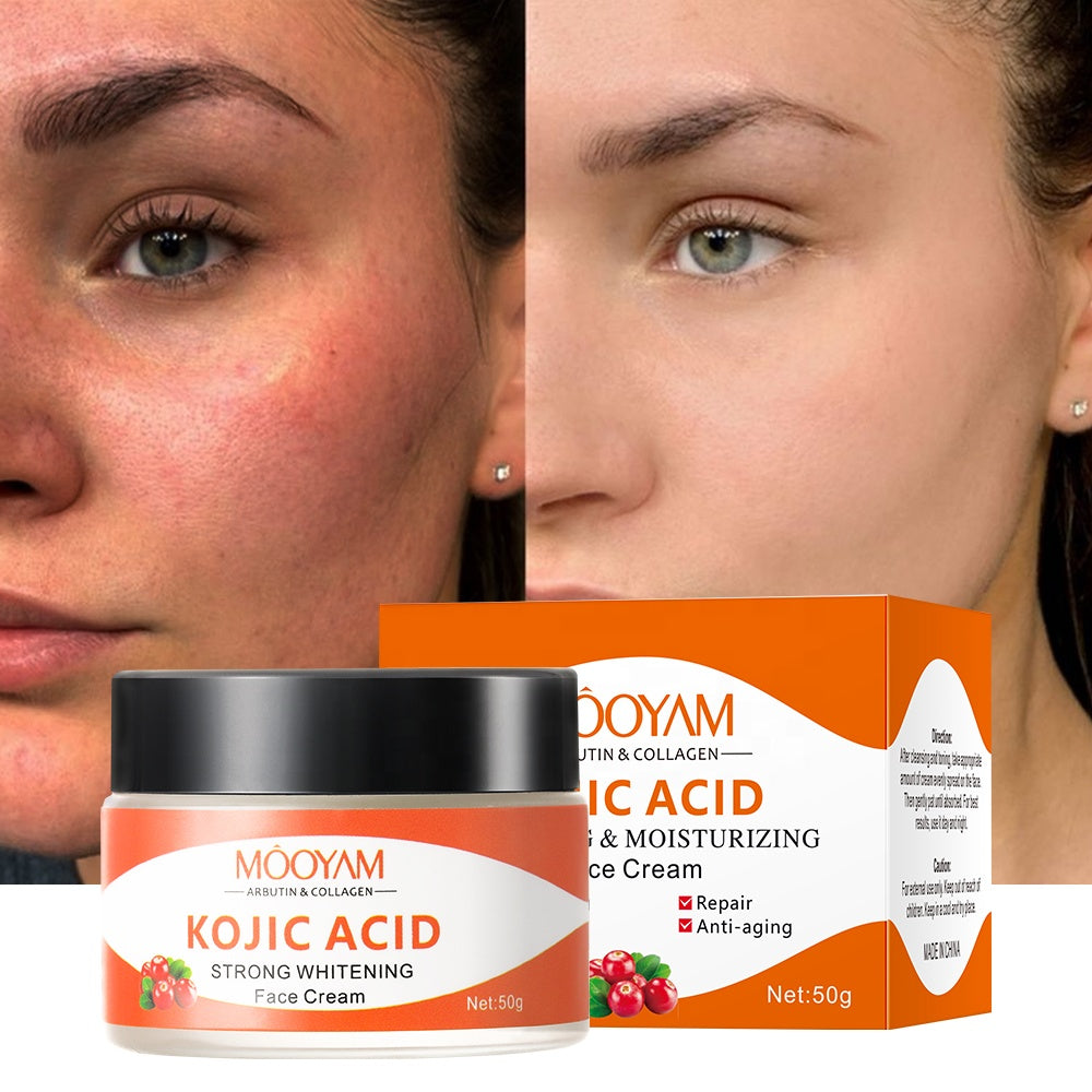 MÔOYAM Kojic Acid Collagen Face Whitening Cream Skin Lightening Cream