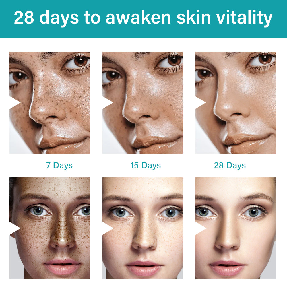 MÔOYAM Strong Effective Freckle Cream Removal Cream