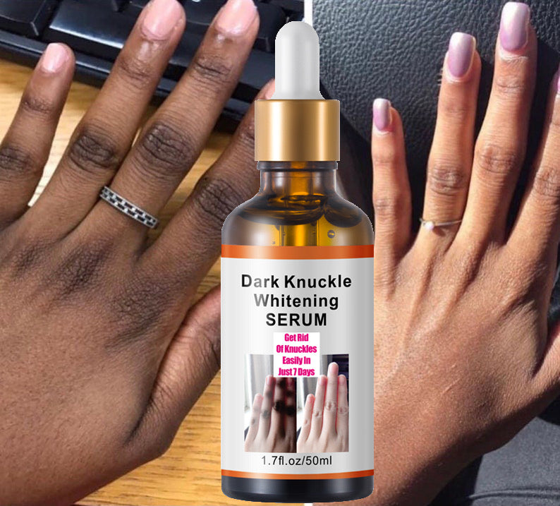 MÔOYAM Get Rid of Dark Knuckles in 7 Days Serum for Elbow and Knees and Knuckles