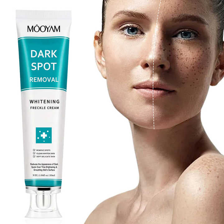 MÔOYAM Strong Effective Freckle Cream Removal Cream