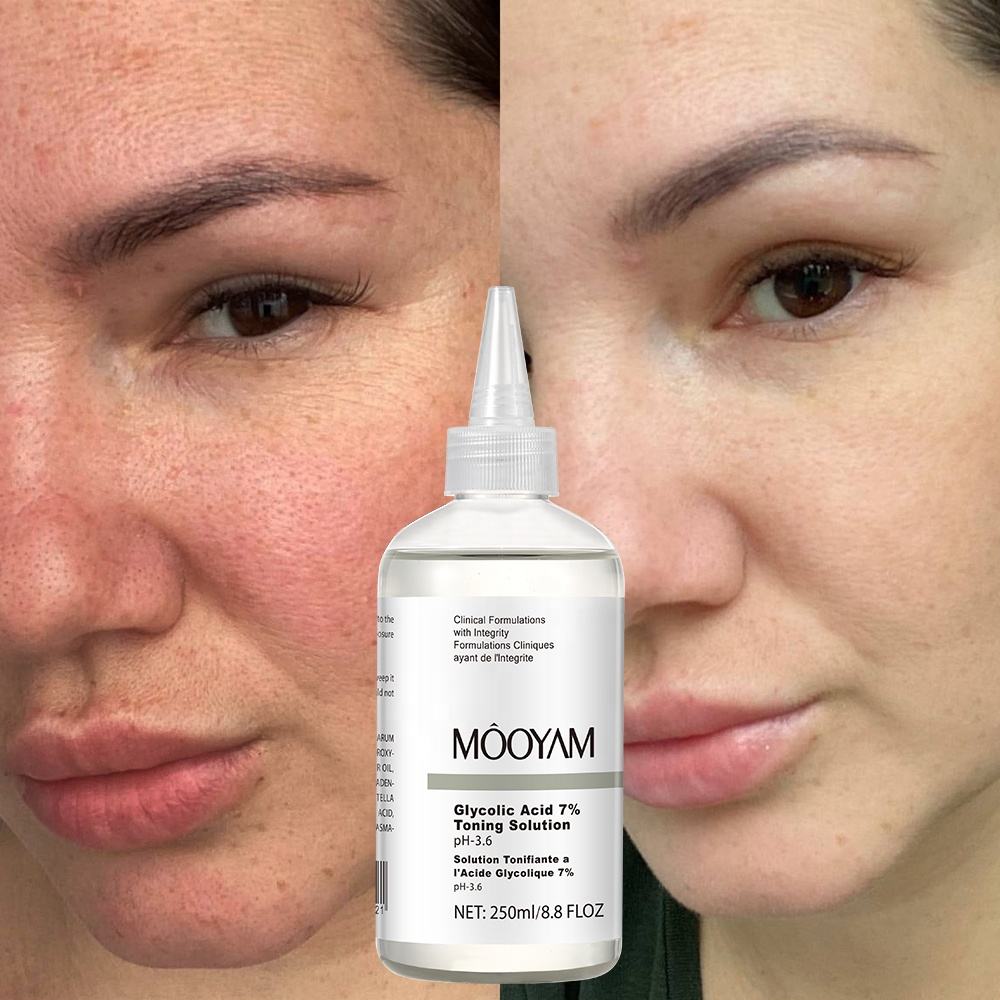 MÔOYAM Glycolic Acid 7% Toning Solution Gentle Exfoliating Toner