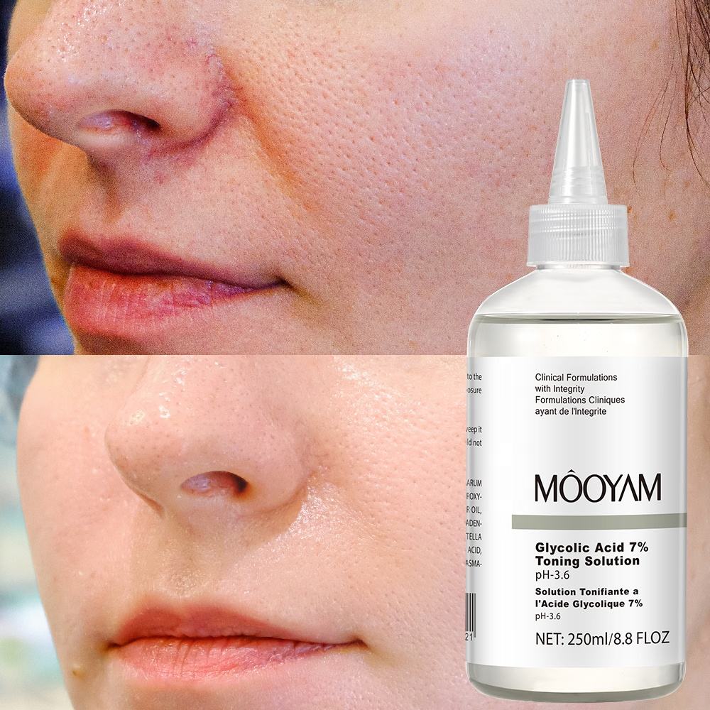 MÔOYAM Glycolic Acid 7% Toning Solution Gentle Exfoliating Toner