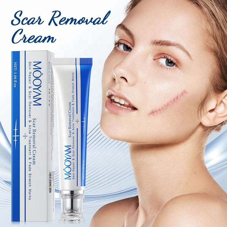 MÔOYAM Fastest Acne Scar & Stretch mark Removal Cream