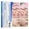 MÔOYAM Fastest Acne Scar & Stretch mark Removal Cream