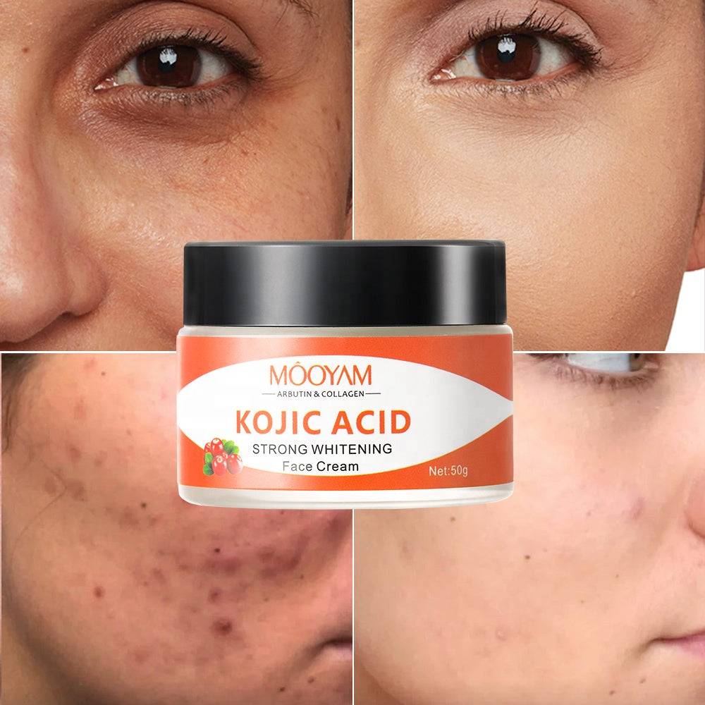 MÔOYAM Kojic Acid Collagen Face Whitening Cream Skin Lightening Cream
