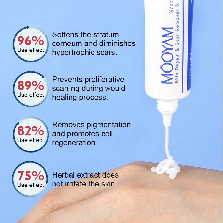 MÔOYAM Fastest Acne Scar & Stretch mark Removal Cream