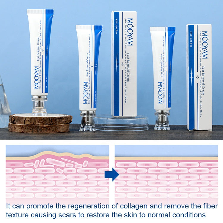 MÔOYAM Fastest Acne Scar & Stretch mark Removal Cream