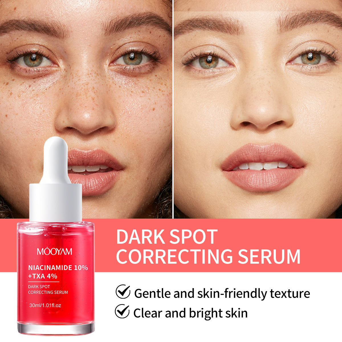 MÔOYAM Niacinamide Serum Dark Spot Remover Skin Brightener & Tone Corrector MOOYAM Facial Serum