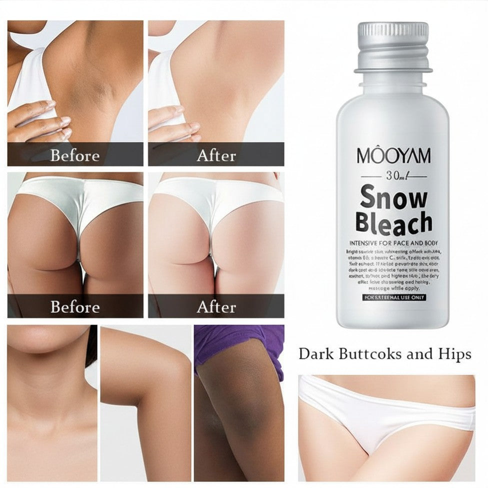 MÔOYAM Snow Bleach (30ml) – Intensive Brightening Cream for Face, Body, Underarms & Sensitive Areas